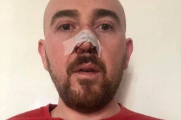 Скорбь патриота: в Польше избили очередного сторонника «майдана»