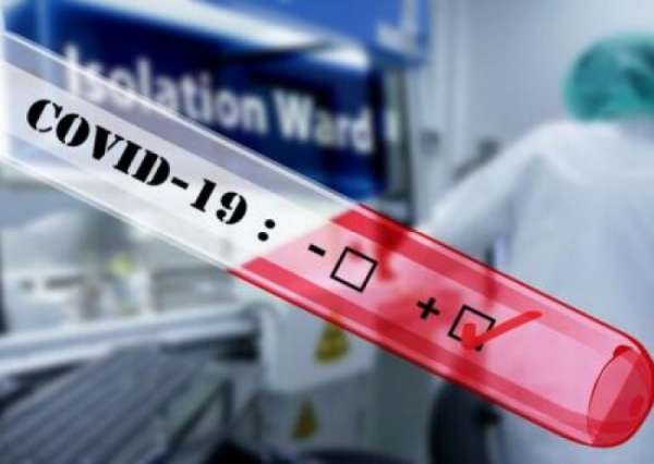 Замглавы Офиса Зеленского «растерял» по пути в Украину подаренные Китаем экспресс-тесты