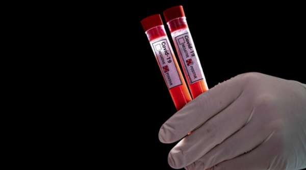 Почему мир не рад русской вакцине от коронавируса