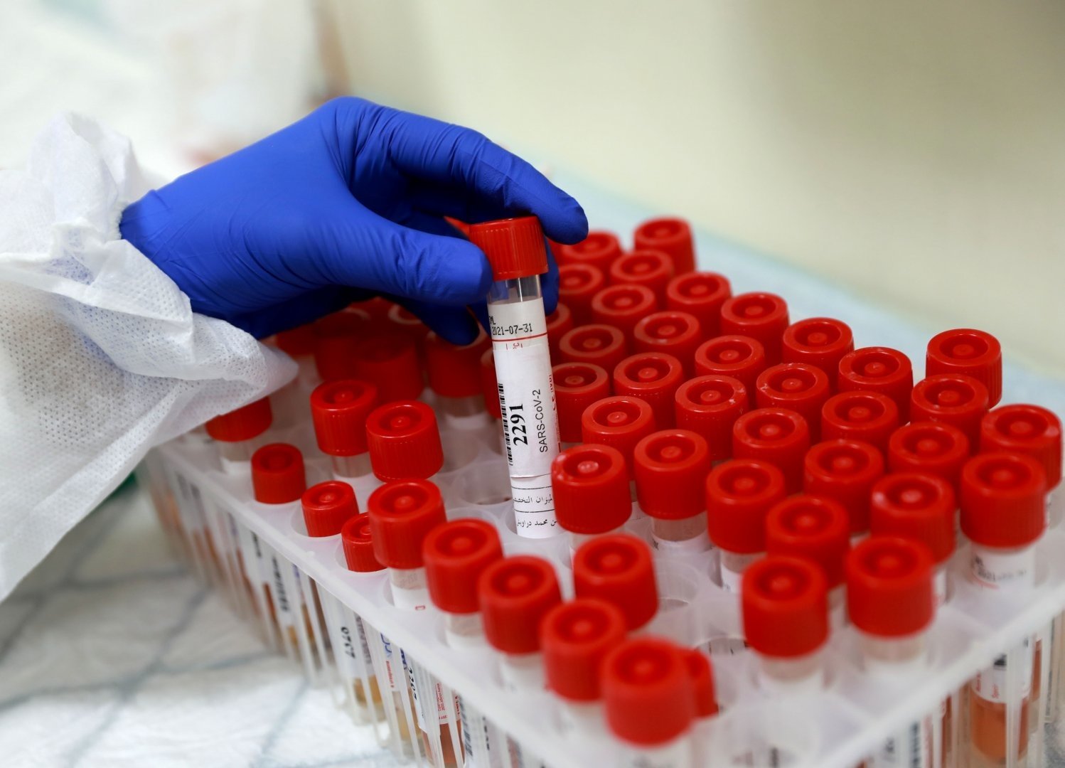 Битва за коронавирус или проверка боем