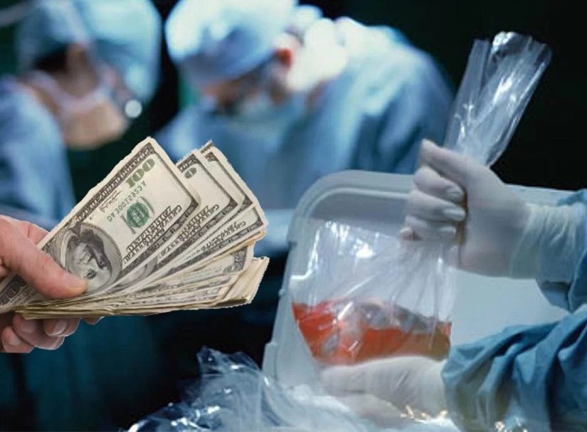 Украинские черные трансплантологи на линии фронта